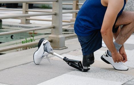 Prosthetics for Ukrainians